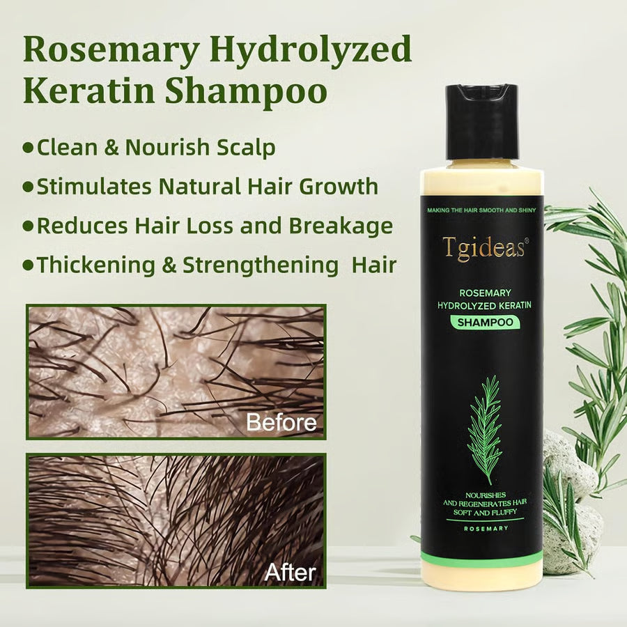 Tgideas Organic Rosemary Shampoo – Boost Growth & Reduce Hair Fall