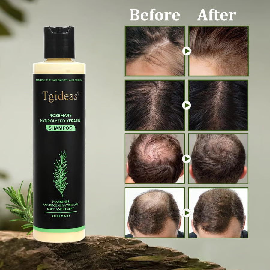 Tgideas Organic Rosemary Shampoo – Boost Growth & Reduce Hair Fall