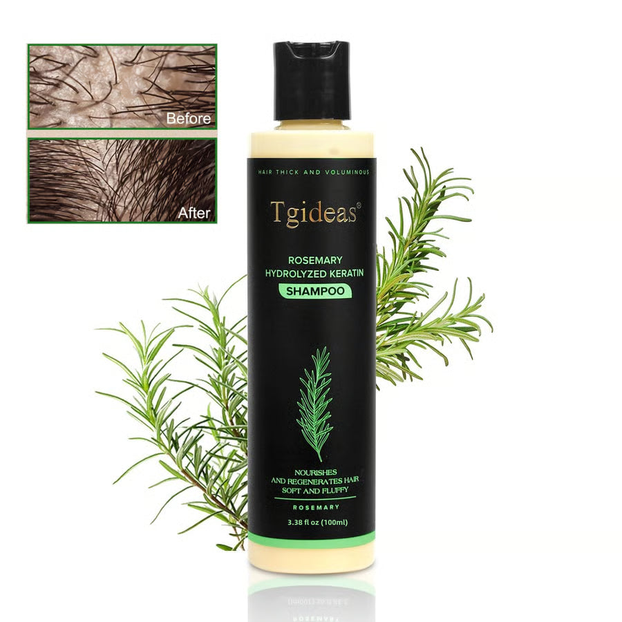 Tgideas Organic Rosemary Shampoo – Boost Growth & Reduce Hair Fall